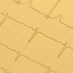 Featured image for Herzfrequenzvariabilität – Wie man EKG-Daten analysiert