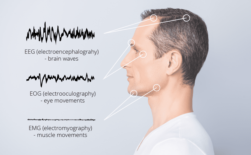 EEG noise sources