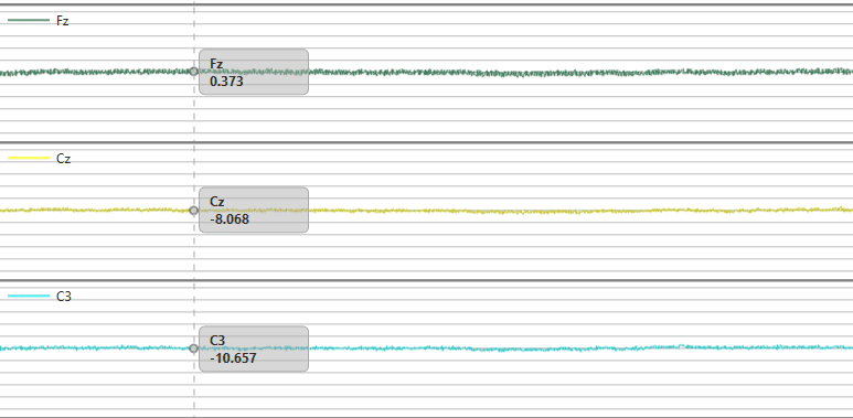 EEG results