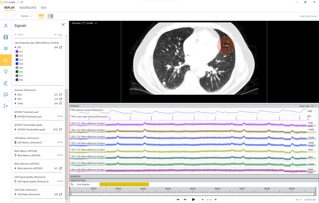 EEG invisible gorilla radiology