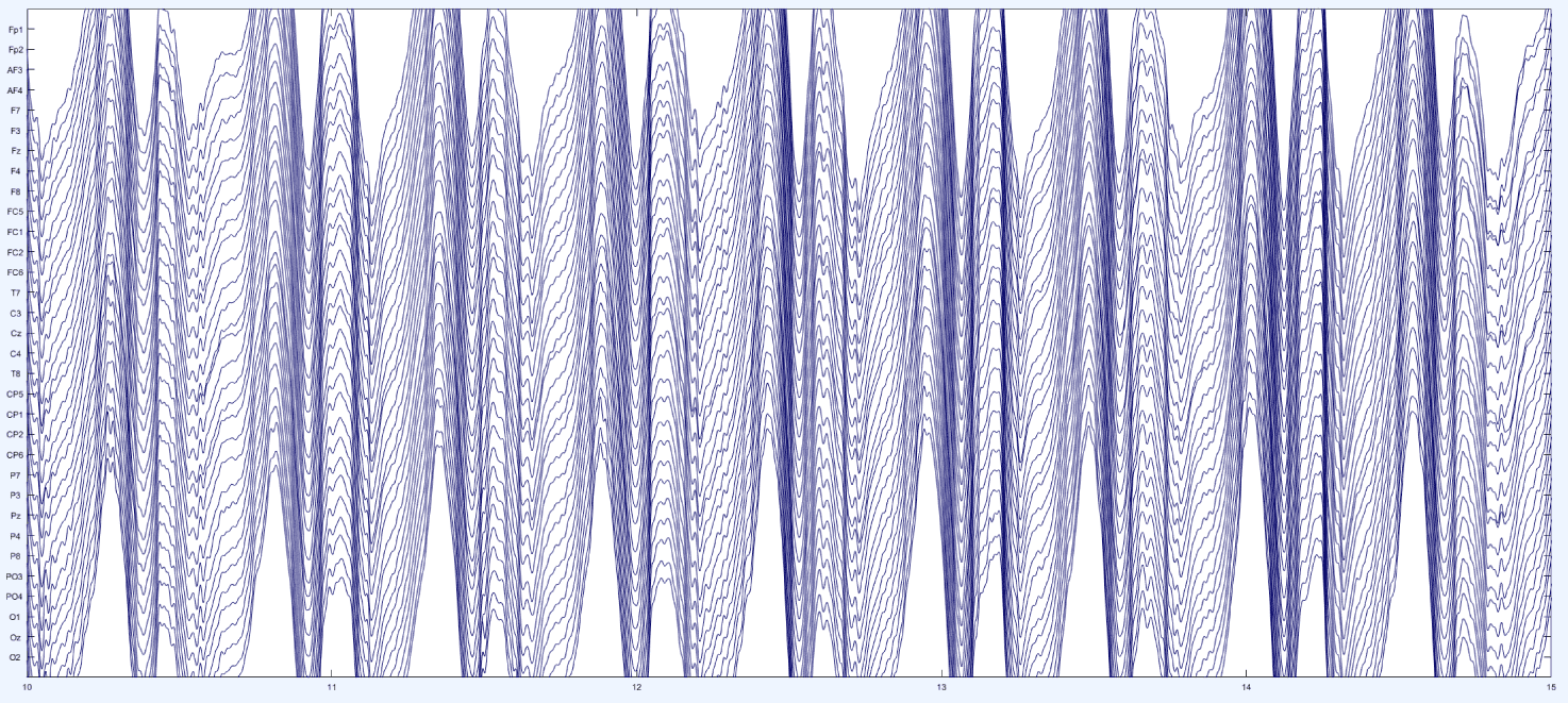 EEG while walking