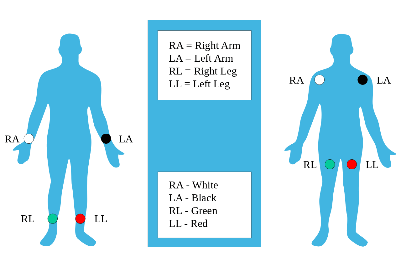 ecg placement ecg