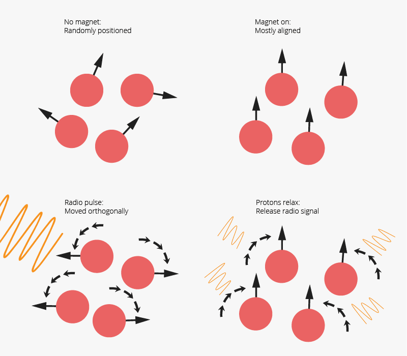 MRI simple explanation