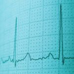 Featured image for Oscillations neuronales – Interprétation des bandes de fréquences de l'EEG