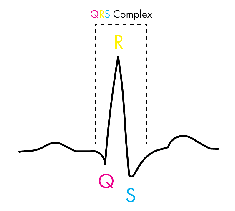 QRS complex