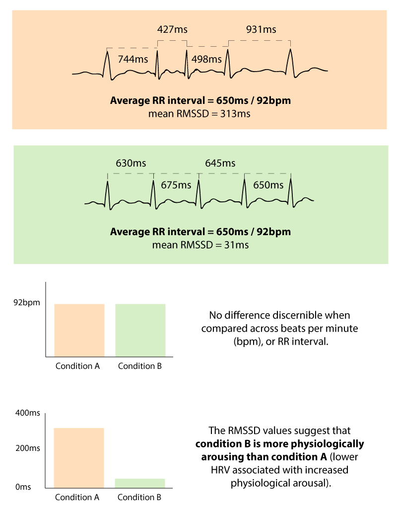 Electrocardiography (ECG) - The Complete Pocket Guide - iMotions