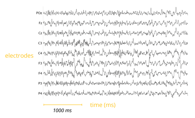 eeg electrodes and time chart