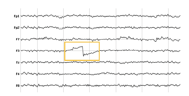 electrode or headset movements