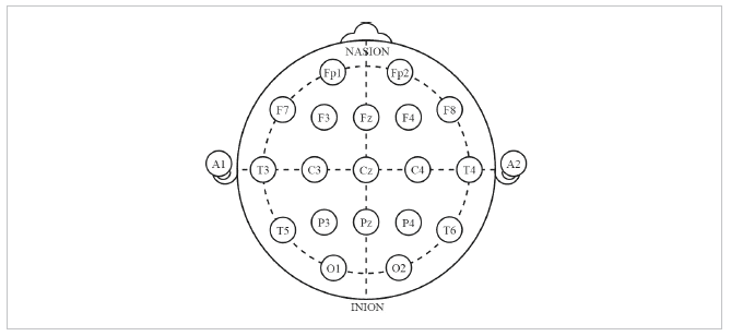 Eeg Electrode Placement