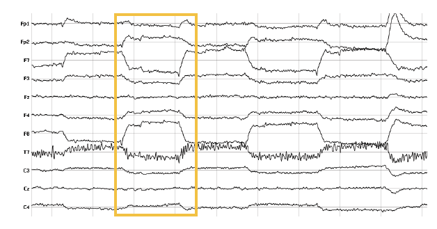 eye movement eeg