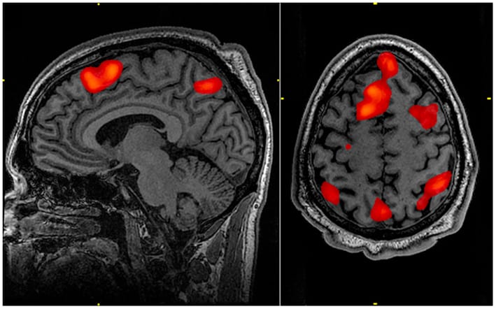 eeg brain scan