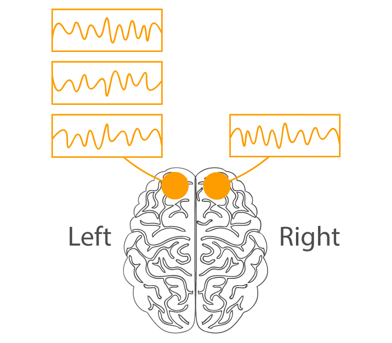  frontal asymmetry attraction 