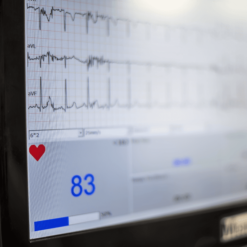 heart rate ecg