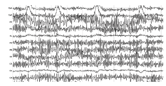 muscle movement eeg