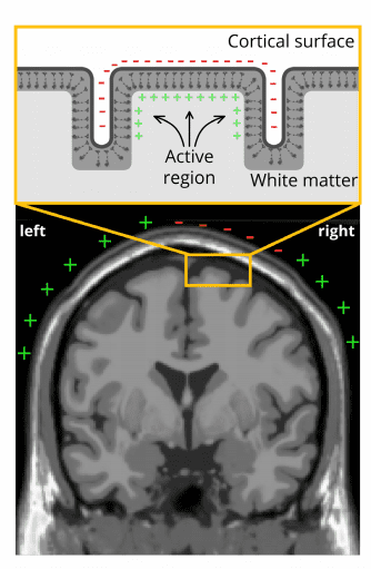 postsynaptic potential scan