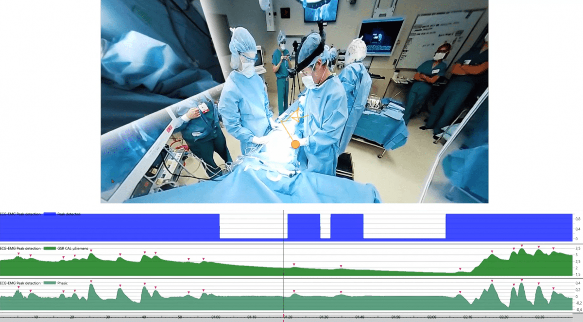 surgery simulation