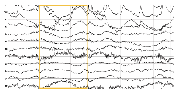 swinging and swaying with eeg