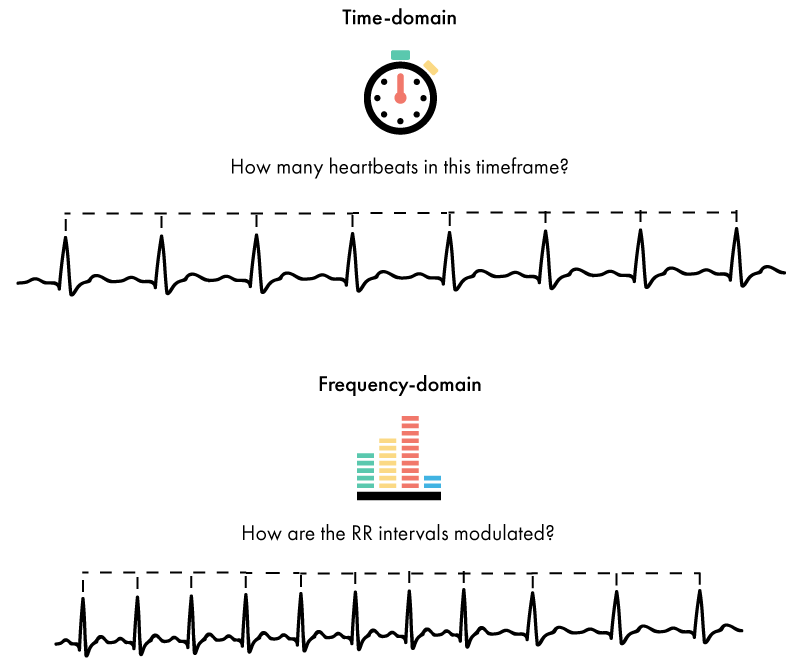 Electrocardiography (ECG) - The Complete Pocket Guide - iMotions