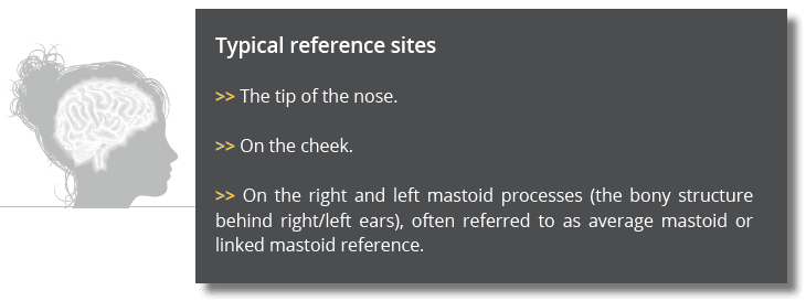 typical reference sites