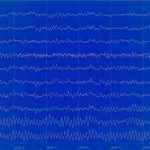 Featured image for 脳波（EEG）研究のトップ5記事