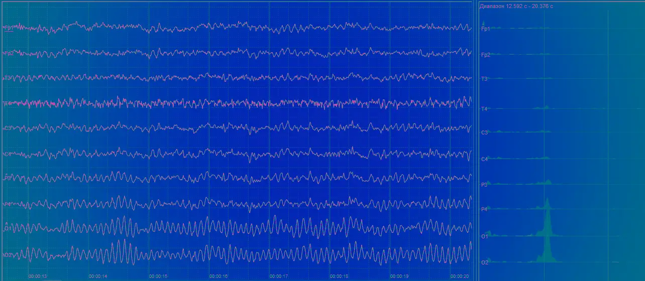 Top 5 EEG Research Articles